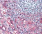 ICAM-1 / CD54 Antibody (clone 15.2)